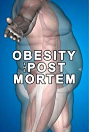 Obesity: The Post Mortem (2016)